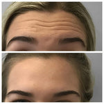 Charger l'image dans la galerie, Botox Naturel  Sérum Anti-Âge Rapide et Efficace SG
