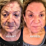 Charger l'image dans la galerie, Botox Naturel  Sérum Anti-Âge Rapide et Efficace SG
